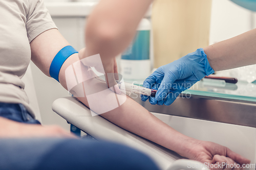 Image of Close-up Of Doctor Taking Blood Sample From Patient's Arm in Hospital for Medical Testing.