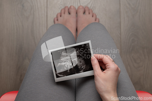 Image of Pregnant woman sitting on chair - top view