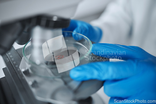 Image of Hands, scientist and microscope with blood petri dish in laboratory for research study, analysis or test. Science, medical professional and doctor with biotechnology, equipment and dna for experiment