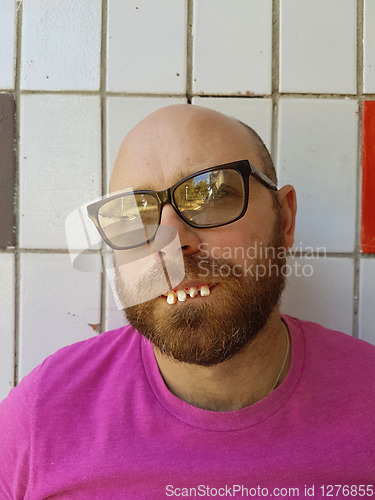 Image of Bald man in eyeglasses with ugly teeth