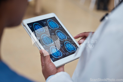 Image of Doctor, hands and tablet with brain scan in healthcare examination, surgery or anatomy research at hospital. Hand of male person or medical professional with technology of head x ray exam at clinic