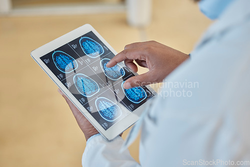 Image of Brain scan, xray and closeup of a doctor with a tablet for a neurology consultation or surgery. Healthcare, digital technology and hands of surgeon analyzing a mri image in medical hospital or clinic