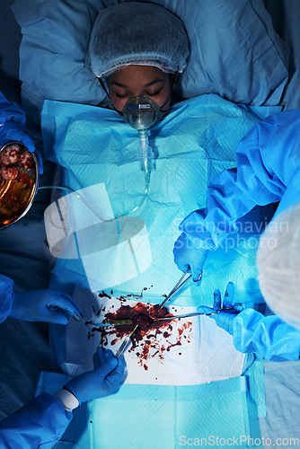 Image of Surgery, patient and medical tools with hands with blood at hospital for emergency with team of doctors. Operation, surgeon and group with working on anatomy for injury at clinic with top view.