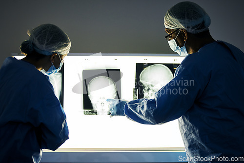 Image of Dentist team, teeth x ray and together for analysis, study and learning in clinic for healthcare. Surgeon group, monitor skull and tooth growth for wellness, care or point with discussion in hospital