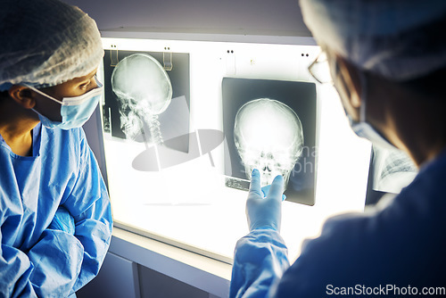 Image of Skull x ray, screen and doctor with analysis of scan, healthcare and surgery with medical team and neurology. Radiology, assessment and plan with people in hospital, surgeon and medicine with anatomy