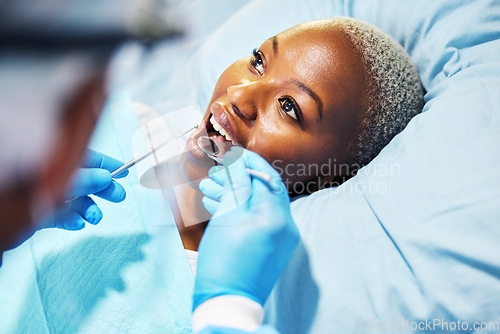 Image of Dentist, inspection and woman with tools in mouth at clinic for cavity, teeth whitening and helping hand for pain. Dental surgeon, African patient and mirror for exam, care or check for healthy smile