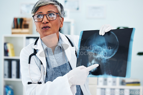 Image of Hospital, doctor and senior woman with x ray for surgery, medical consultation and in diagnosis with patient. Healthcare, medicare and female health worker explain with head scan for injury analysis