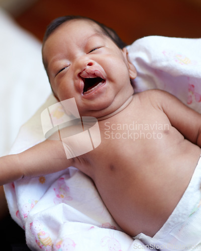 Image of Cleft lip, baby and child birth with a portrait of a newborn crying in her crib at home. Childcare, young and infant girl kid with a medical condition laying on a blanket in her nursery in hospital