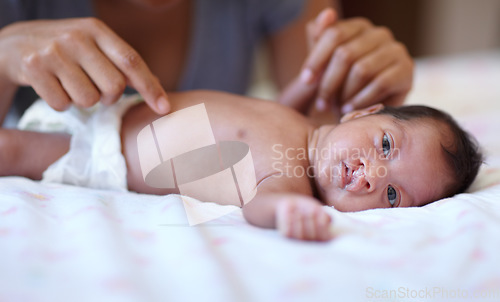 Image of Care, portrait and a baby with a cleft palate being changed, playing and hands of a mother with love. Family, health and a newborn child with a disability and a mama or parent for childcare