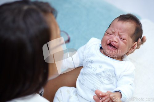 Image of Crying, mother and a baby with a cleft lip in the bedroom of the home together for love or care from above. Healthcare, medical and child with a disability in the arms of a mom in a house for comfort