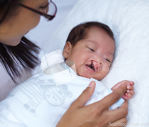 Image of Newborn, cleft palate and parent care for a baby happy in a home bed with a smile in a bedroom or medical centre. Health, healthcare and young child or kid bonding with mother with love and comfort
