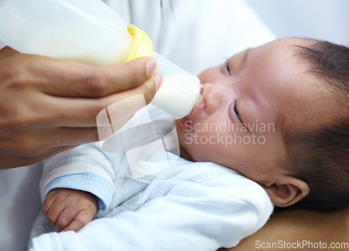 Image of Baby with cleft lip, milk and mom feeding from bottle for nutrition, health and wellness. Formula, newborn and hand of mother feed child for development, growth or healthy diet, food or lunch at home