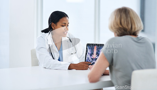 Image of Doctor, woman and tablet with spine x ray, feedback or advice for injury, pain or talking with app for support. Medic, women and touchscreen for physiotherapy, osteoporosis and explain for healthcare