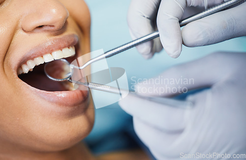 Image of Dentist, healthcare and hands, patient mouth and medical tools, surgery and dental health. Tooth decay, orthodontics procedure and people in clinic for oral care, metal instrument and gingivitis