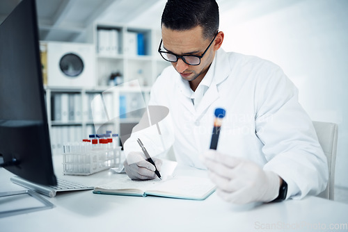 Image of Man, scientist and writing with blood sample for research, cure or vaccine discovery in science lab. Male person or medical expert with notebook for scientific DNA, test or results in the laboratory