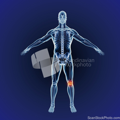 Image of Body, knee pain and skeleton of bones on x ray scan on digital screen. Research of bone and hologram of a person with an internal injury, xray results or feedback of patient exam or operation