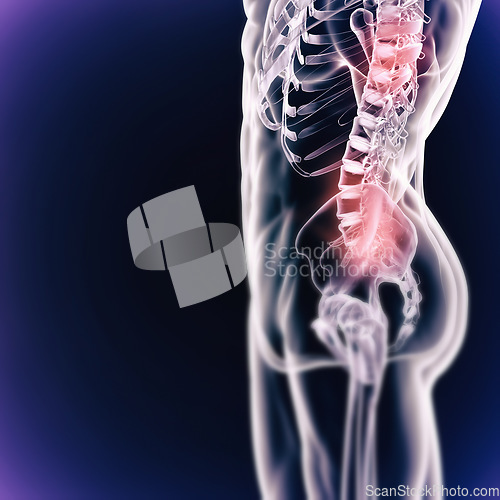 Image of Scan, anatomy and skeleton bones of body on x ray digital background. Graphic of human person in pain, medical and research or results of xray of back injury or fractured joint or spine of a patient