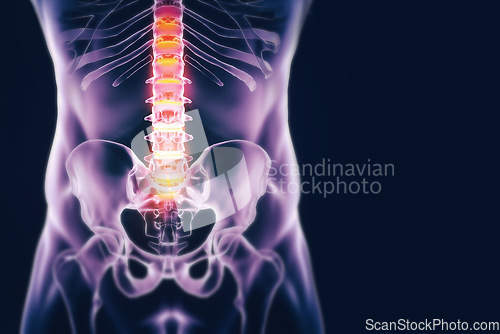 Image of Spine, anatomy and xray for healthcare, medical or insurance in studio on a dark background to diagnose a bone condition. Surgery, physiotherapy and emergency with a skeleton scan of a patient