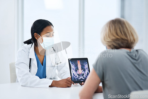 Image of Doctor, patient and woman with tablet for spine, feedback or advice for injury, pain or safety with mask for covid. Medic, women and touchscreen for consulting, osteoporosis and explain with x ray