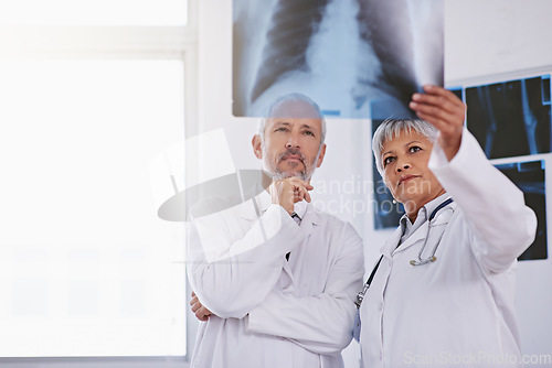 Image of Senior team of doctors, review xray for surgery and people in radiology, cardiovascular health at clinic. Lung scan, old man thinking about diagnosis and woman surgeon collaboration with assessment