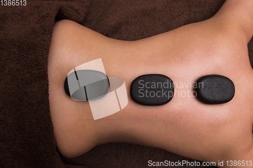 Image of therapy with hot stones in spa center