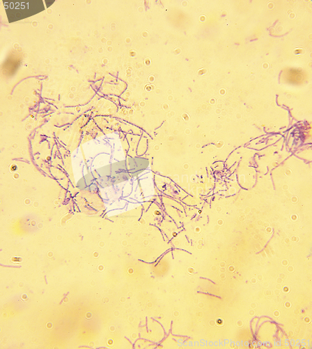 Image of Microscope-Anthrax-Bacillus anthracis