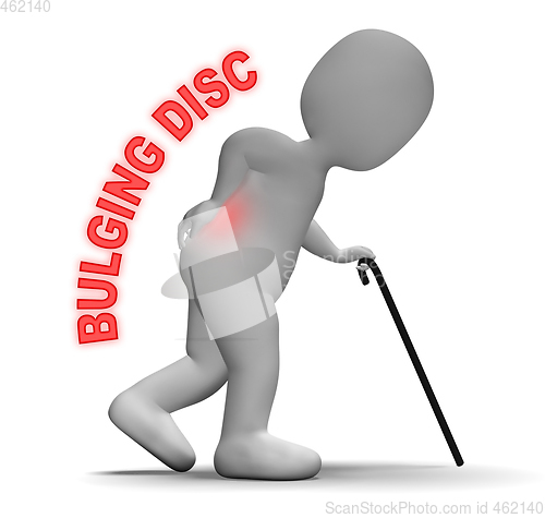 Image of Bulging Disc Shows Back Chiropractor 3d Rendering