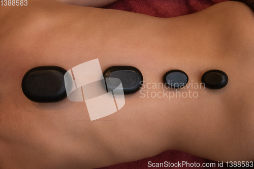 Image of therapy with hot stones in spa center