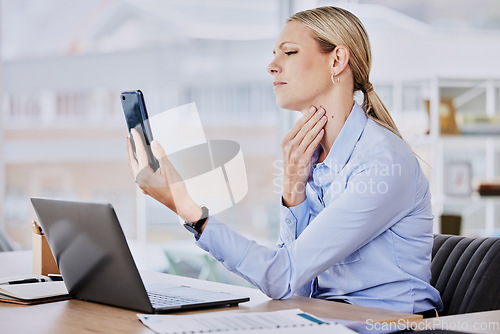 Image of Business woman phone, throat pain and sick employee in a office on a video call with online doctor. Worker, female person and virus problem at a company with mobile consultation checking neck