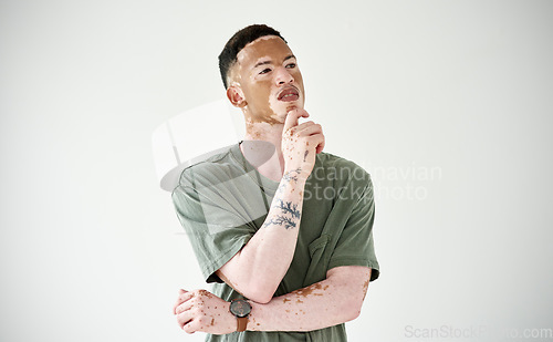 Image of Memory, man against a studio backdrop and thinking for problem solving. Solution or decision, remember or doubt and isolated young male person with vitiligo against white background for inspiration