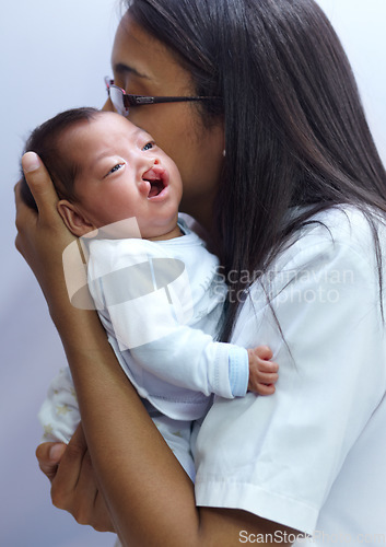 Image of Healthcare, cleft palate and a pediatrician with a baby in the hospital for insurance, care or treatment. Medical, kids and a doctor woman holding a newborn with a disability in a health clinic