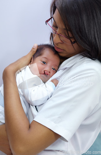 Image of Medicine, cleft lip and a pediatrician with a baby in the hospital for healthcare, insurance or treatment. Medical, children and a doctor woman holding a newborn infant with a disability in a clinic