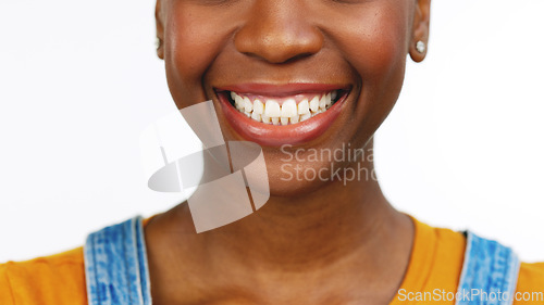 Image of Black woman, teeth and smile for dental care, whitening or healthcare against a white studio background. Happy isolated African American female smiling for tooth, mouth or gum and oral hygiene