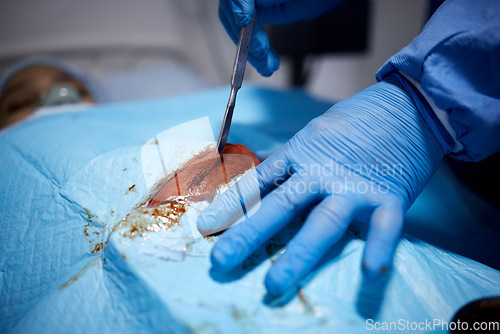 Image of Blood, hands or doctors cutting in surgery or emergency procedure or healthcare operation in hospital. Knife, medical safety tools or closeup of surgeon in gloves helping in operating room in clinic