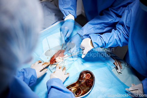 Image of Emergency, hands or surgeons cutting in surgery or procedure or healthcare operation in hospital. Gloves closeup, medical tools or team of doctors helping in operating room with cotton or knife