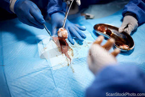 Image of Blood, hands or surgeons cutting in surgery or emergency procedure or healthcare operation in hospital. Gloves closeup, medical safety tools or team of doctors helping in operating room with cotton