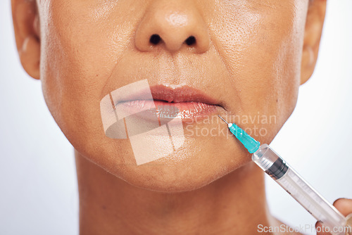 Image of Lips, injection and face of woman for plastic surgery in studio, white background and skincare. Closeup of female model, cosmetics and syringe on mouth for dermatology, facelift and filler for beauty