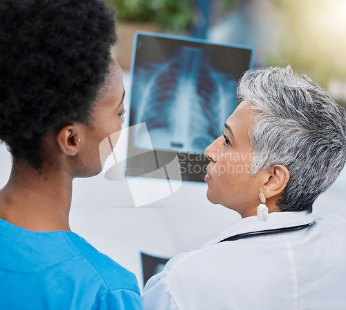 Image of X ray, senior woman analysis and doctor team with conversation and medical collaboration. Healthcare, clinic and hospital worker with an xray doing problem solving with professional assessment