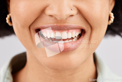 Image of Smile, dental teeth and face of black woman in studio isolated on a white background. Tooth care, cosmetics and happiness of female model or person with lip makeup, gums and oral health for wellness