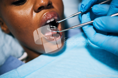 Image of Mouth, woman and hands of dentist in dental surgery for clean teeth, denchers or oral hygiene at clinic. Female in tooth whitening treatment with tools for cleaning gum bacteria, disease or decay