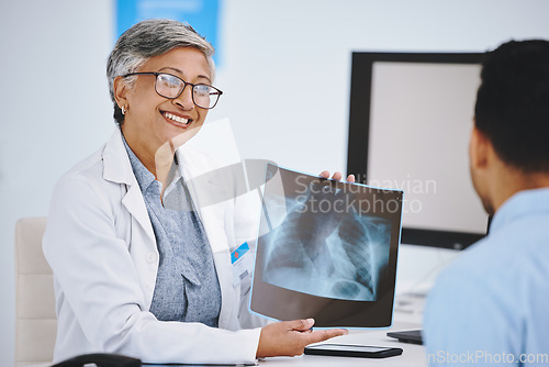 Image of Happy, showing x ray and doctor with a man for medical advice, help and conversation. Radiology, healthcare and a mature woman holding a picture to show a patient results, research and hospital scan