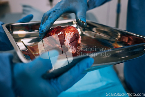 Image of Hospital, doctor and organ transplant surgery in operating room with hands, healthcare and medical emergency. Blood, people hand and closeup of donor operation for healthy organs and surgeon at work