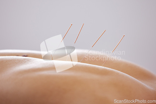 Image of Person, back and acupuncture with wellness massage, spa treatment and luxury with body care. Human, model and physiotherapy with self care, needles and alternative pain healthcare with stress relief