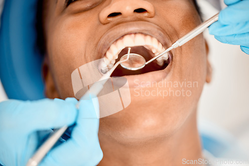 Image of Dentist, black woman mouth and patient at a clinic with medical and healthcare for teeth cleaning. Mirror, orthodontist and African female person with wellness and dental work tool with care