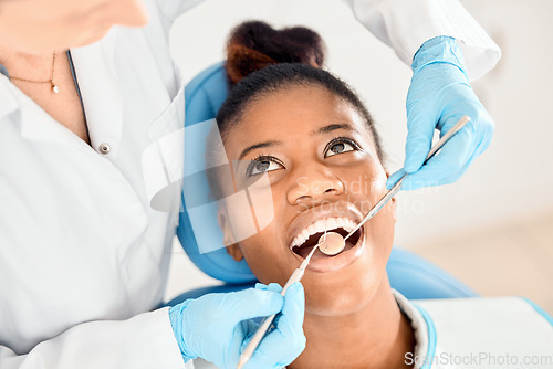 Image of Dentist, black woman and mouth cleaning of patient at a clinic with medical and healthcare for teeth. Mirror, orthodontist and African female person with wellness and dental work tool with care