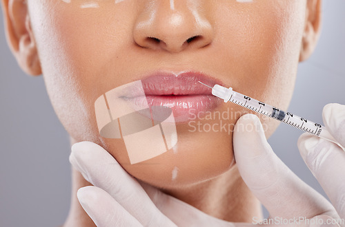 Image of Closeup, lip filler and botox with woman and injection for plastic surgery, dermatology and beauty. Pattern, aesthetic and medical with model and syringe on grey background for collagen and cosmetics