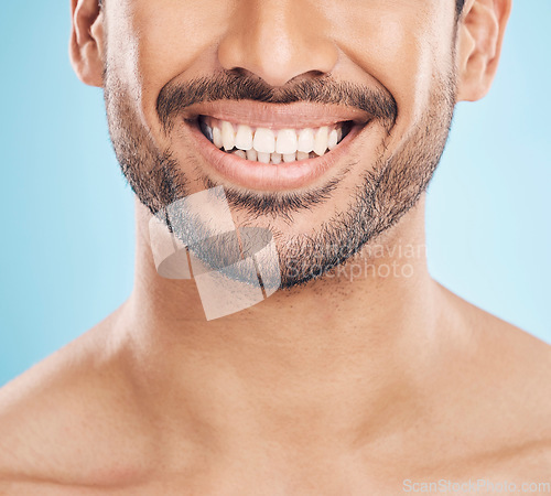 Image of Smile, teeth whitening and mouth of a man on a studio background for a dentist treatment. Health, wellness and tooth results of a person or model with dental or oral surgery on a backdrop for beauty