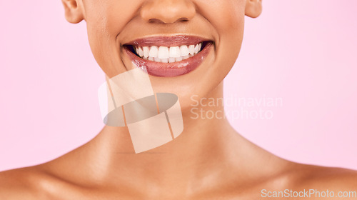 Image of Woman, teeth and smile, beauty and dental with shine on lips, oral health and veneers isolated on pink background. Female model, orthodontics and wellness, cosmetics and closeup of mouth in studio