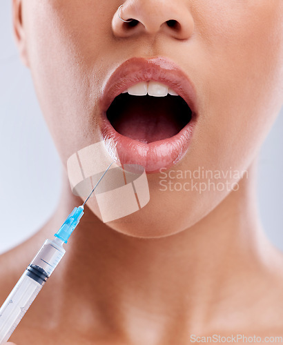 Image of Lip filler, injection and beauty, woman with surprise and cosmetic surgery closeup on white background. Skincare, liquid collagen and female model with wow face, mouth and syringe with dermatology