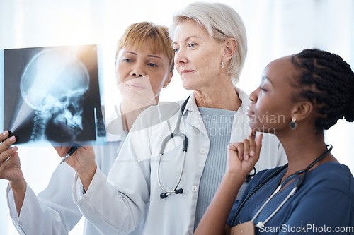 Image of Xray, women doctors and radiology team planning for test, results charts and healthcare analysis advice. Medical group, neurology and hospital x ray scan of skull, anatomy and review for mri analysis